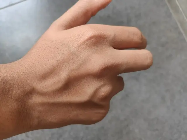 Close view of the back of a relaxed hand and wrist showing raised veins under the skin, against a grey floor