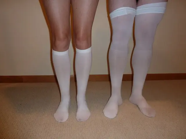 Knee-high and thigh-high compression stockings worn on bare legs, standing on a carpet against a plain wall