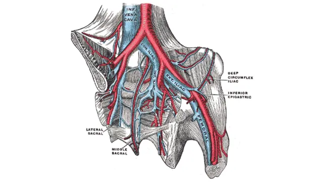 Anatomical illustration of the pelvic arteries in red and veins in blue, labelled with the inferior vena cava and iliac vessels